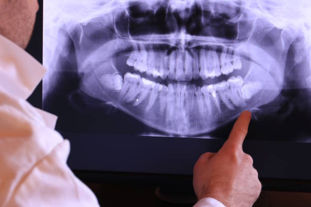 Best Orthodontic Emergency Dentist in Trainer, PA